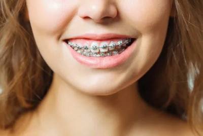 Orthodontist Melbourne