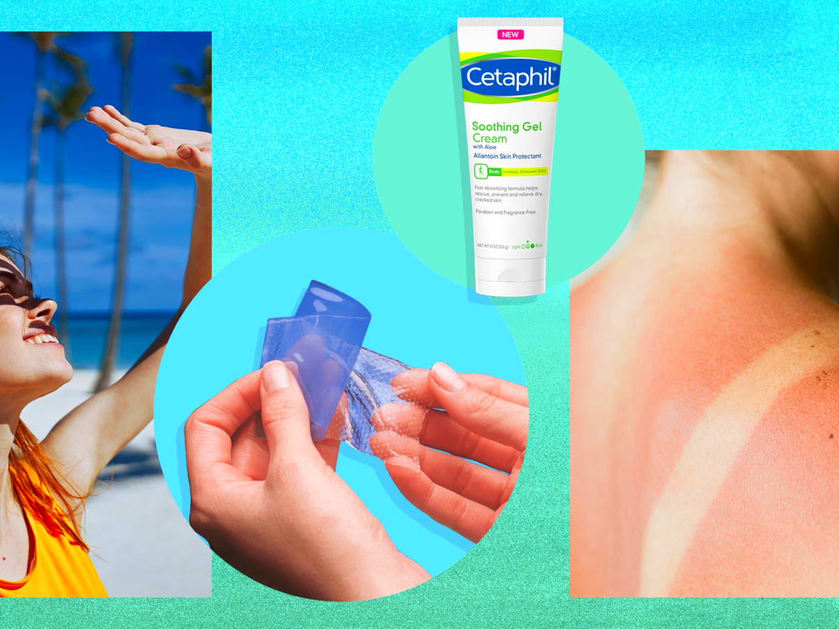 The Best Lotion For Sunburn by Shakender