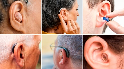 Top 5 factors to consider when choosing a hearing aid