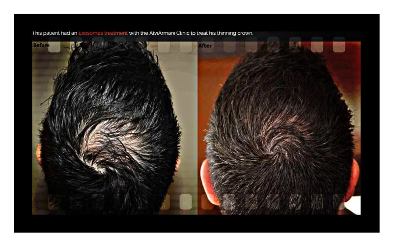 Hair Growth Solutions for Thicker, Stronger, Healthier Hair