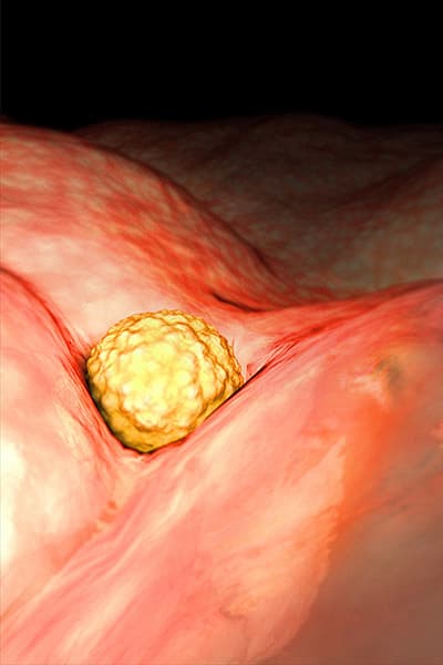 Your fertilized egg, known as a zygote, is a ball of 32 cells that's about the size of a poppy seed.