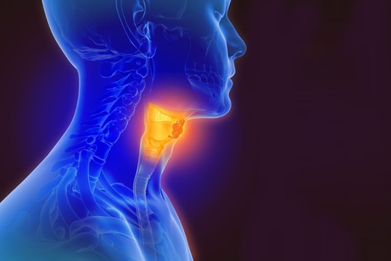 Causes of Head and Neck Cancer