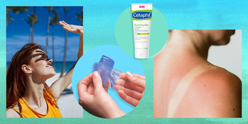 The Best Lotion For Sunburn