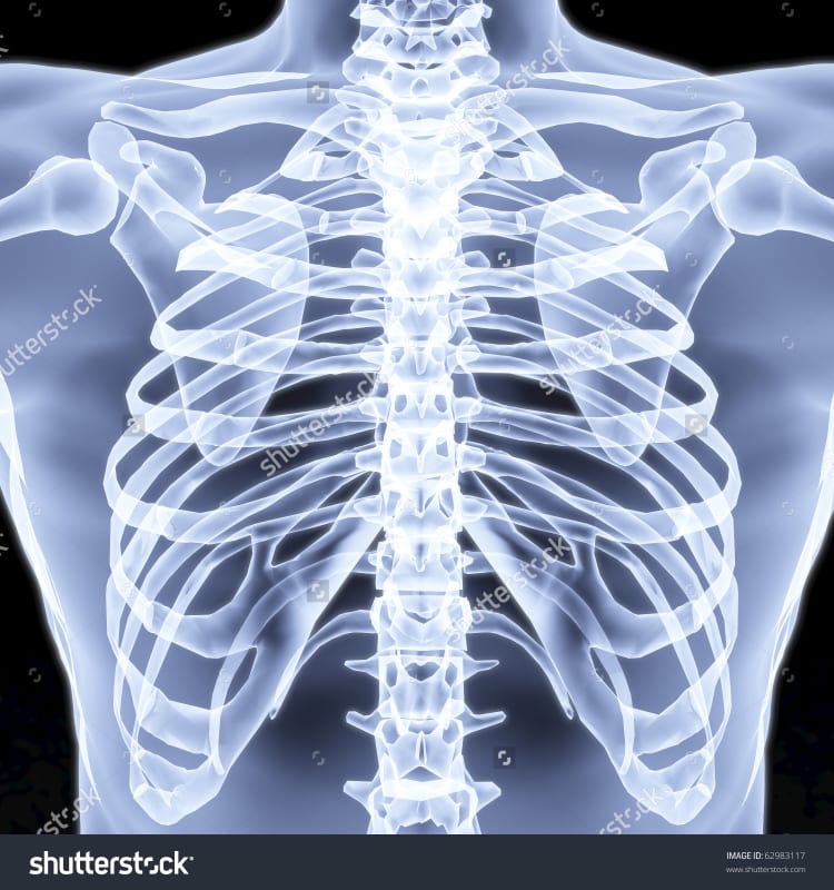 X-rays or ultrasounds