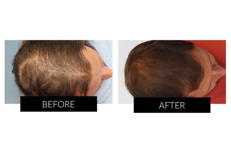 TNT Hair Restoration