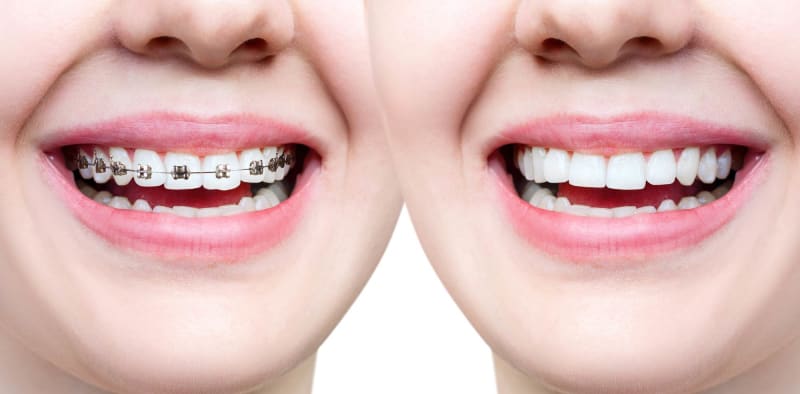 New Smile Dental Preston